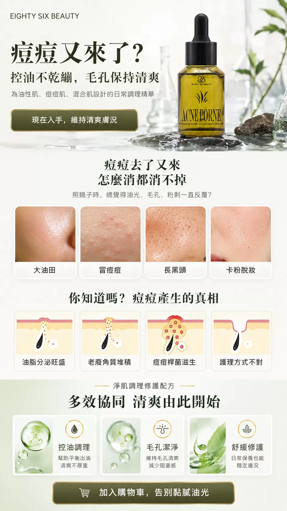 淨肌平衡精華液首屏圖，主打油性肌、混合肌日常使用，清爽膚觸不厚重，適合在意油光與毛孔粗糙感的人。