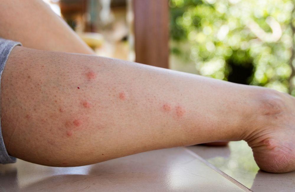 小黑蚊剋星真的有效嗎？先搞懂問題出在哪