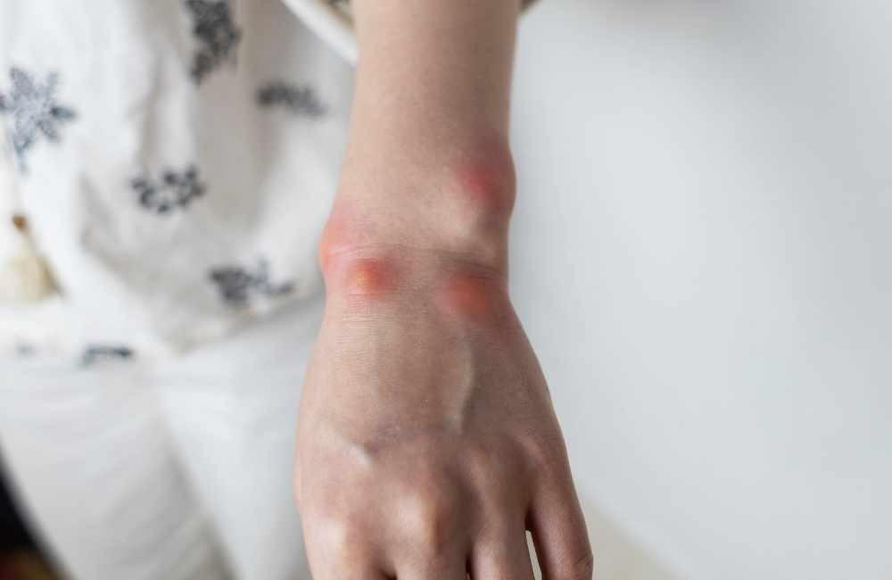 小黑蚊防治必看：為什麼越打越多？3大關鍵破解