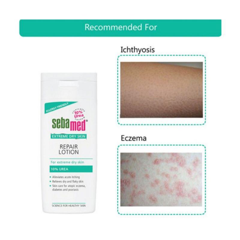 Sebamed Dry Skin Repair Lotion 10% Urea 200ml