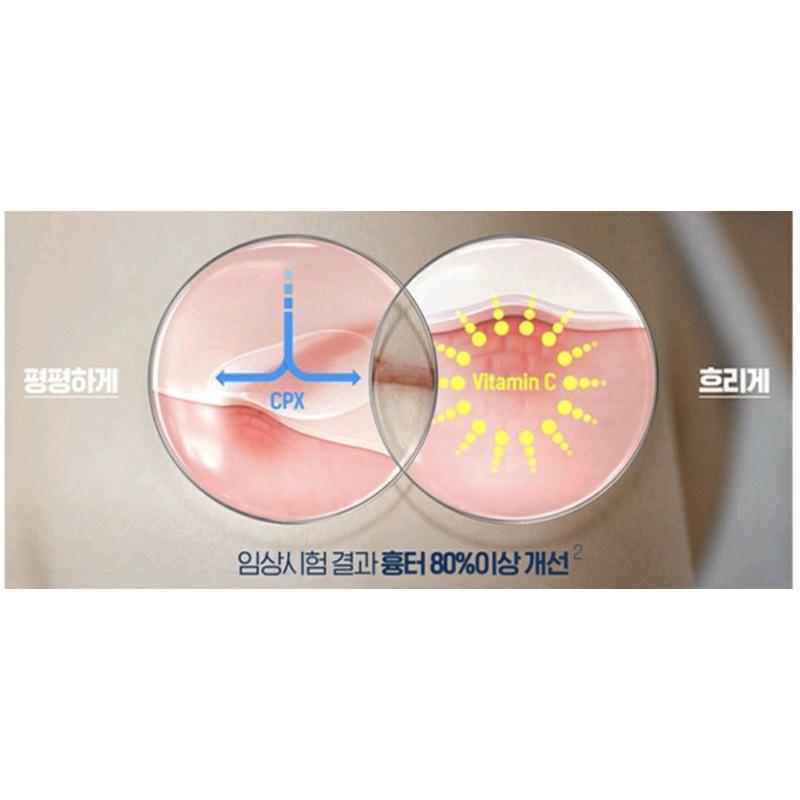 Dermatix Ultra care for kids  Scar 9g 嬰幼兒疤痕凝膠