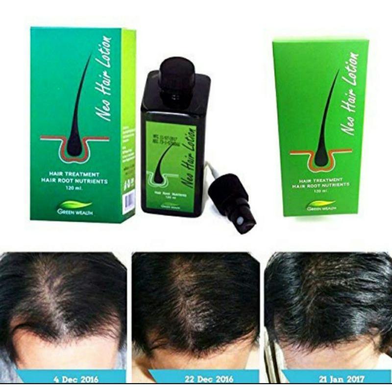 Neo Hair Lotion120ml