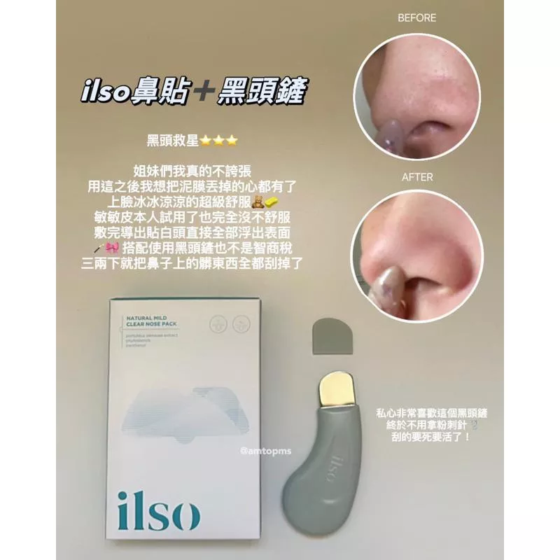 ♡現貨♡送刮棒！ilso鼻貼➕黑頭鏟 ⭐️闆娘推薦實拍實錄⭐️ 黑頭救星💕🤟🏻🤟🏻