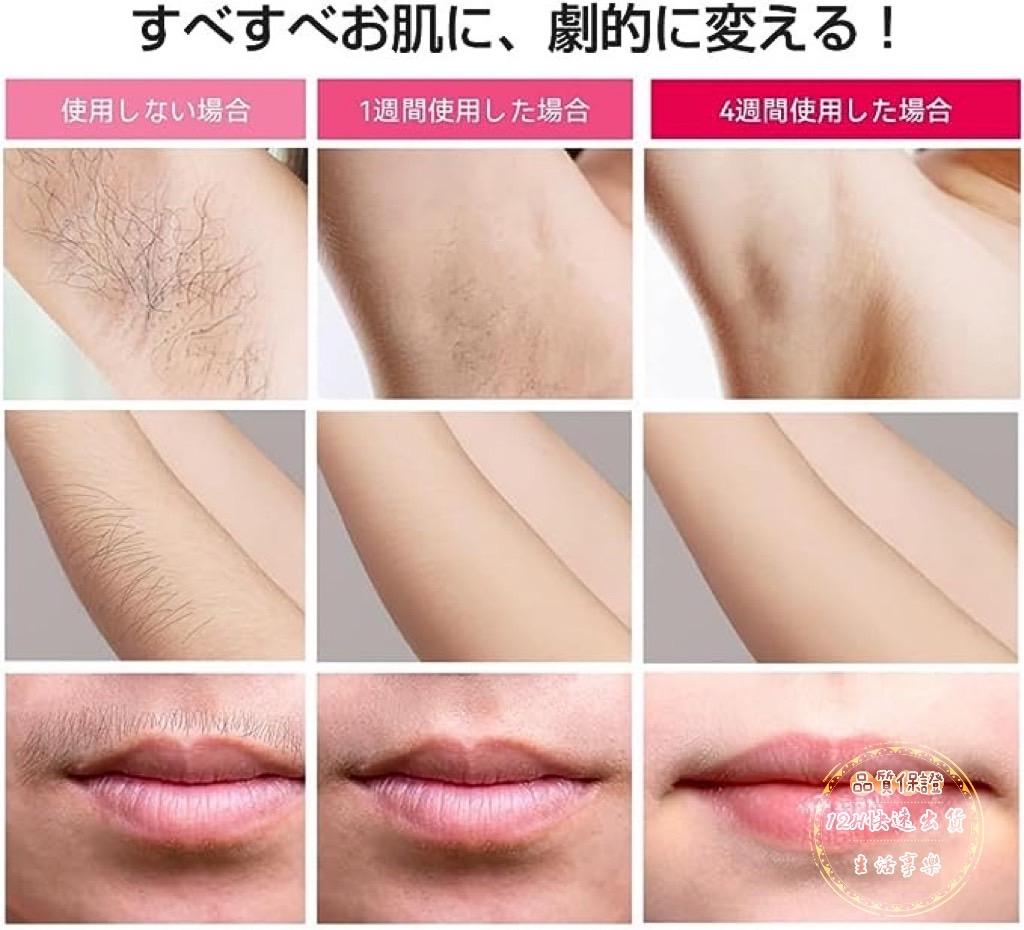 日本原裝 最新沙龍級 IPL光 Cheergo 脱毛器 家用 光美容器 臉部 美肌