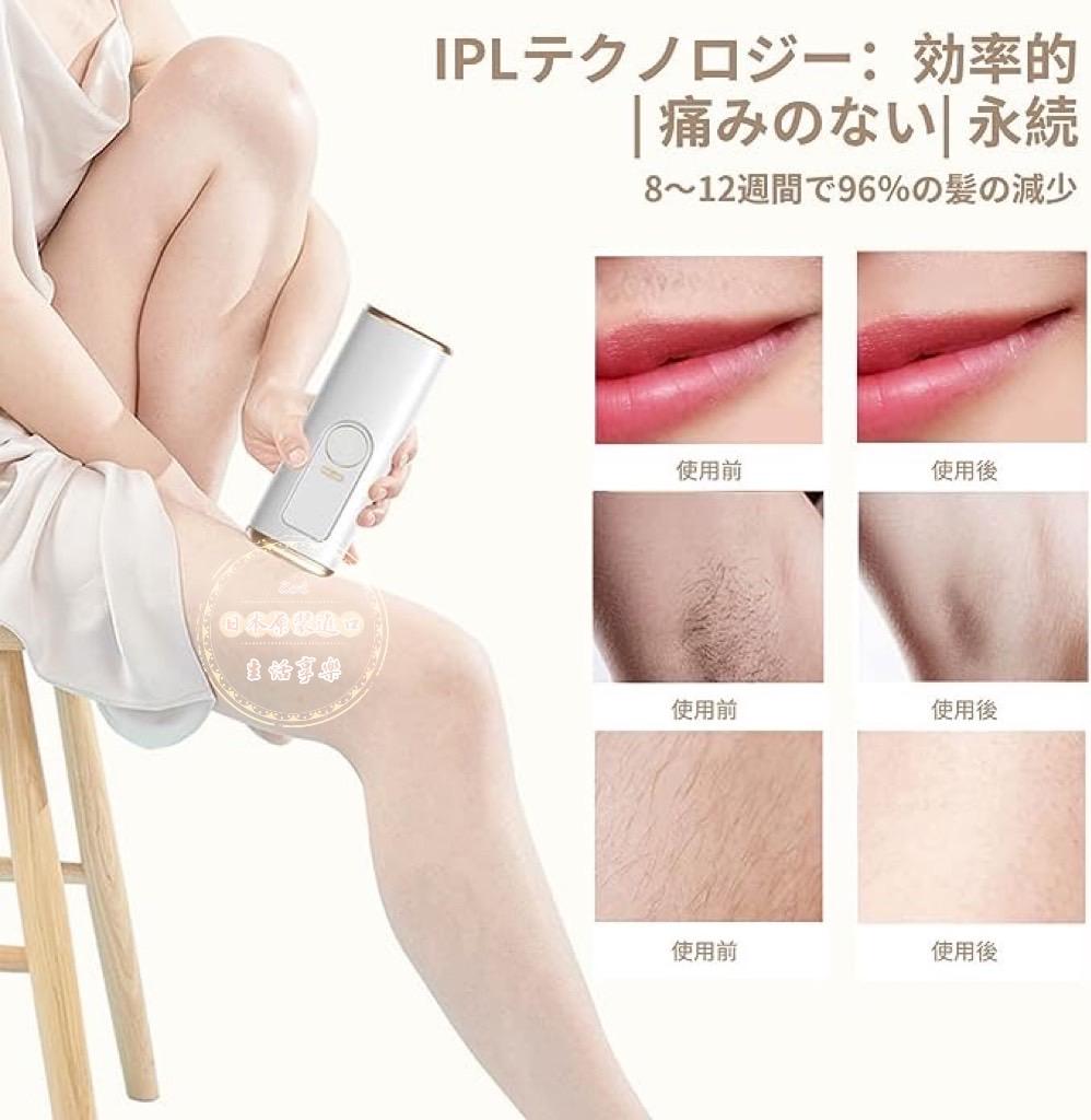 Jeezfee 脫毛器 99萬發照射 家用脫毛器 5檔調節 手動/自動/連續照射模式