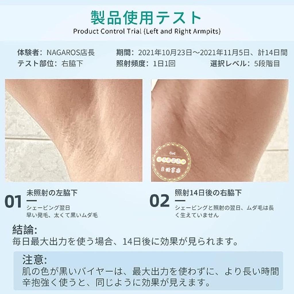 Nagaros 光脫毛器 IPL脈衝技術 5級等級 家用脫毛器