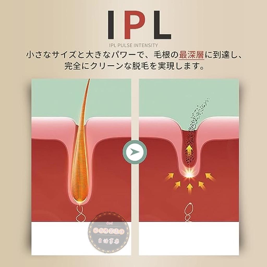 Benicci 脫毛器 IPL光脫毛器 99萬照射 男士 女士 5檔自動照射 全身適用 vio
