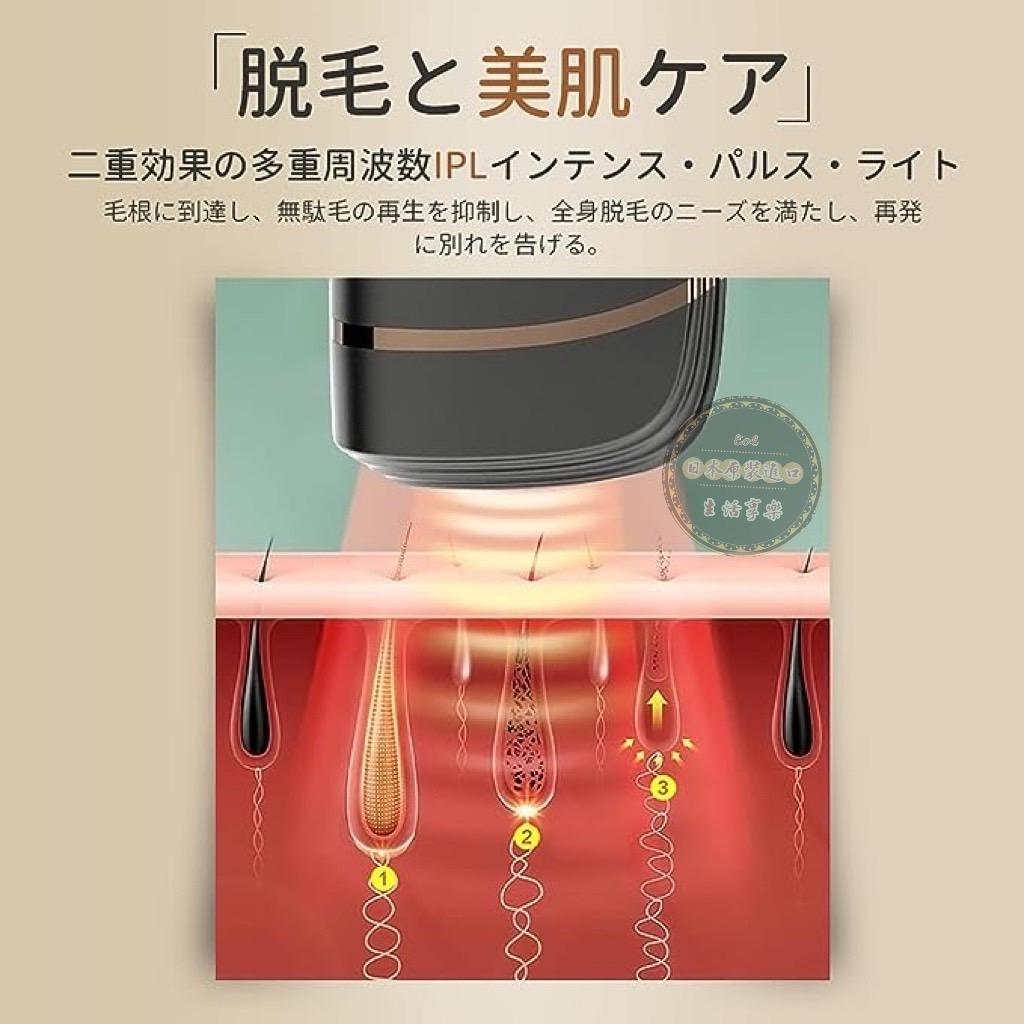 Benicci 脫毛器 IPL光脫毛器 99萬照射 男士 女士 5檔自動照射 全身適用 vio